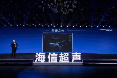 九年磨一劍 海信超聲的夢想征程與技術突破